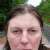 Wuchereria_bancrofti profile picture